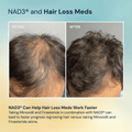 NAD3® 60 • Un suplemento dietético totalmente natural NAD+ Booster® (suministro para 1 mes) 